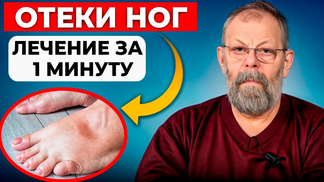Отеки, вены, трудно дышать 1 упражнение поможет за 1 минуту смотреть онлайн