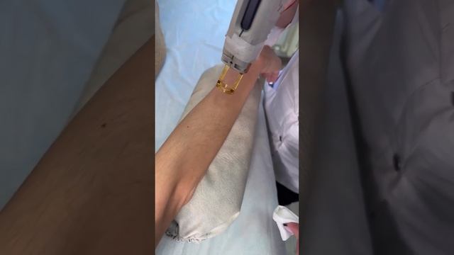 александритовый лазер Candela @laser_candela_blg смотреть онлайн