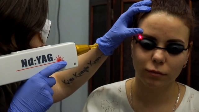 Лазерное удаление татуировок и перманента смотреть онлайн