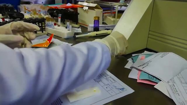 HepBs Ag test Procedure ( clear explain ) смотреть онлайн