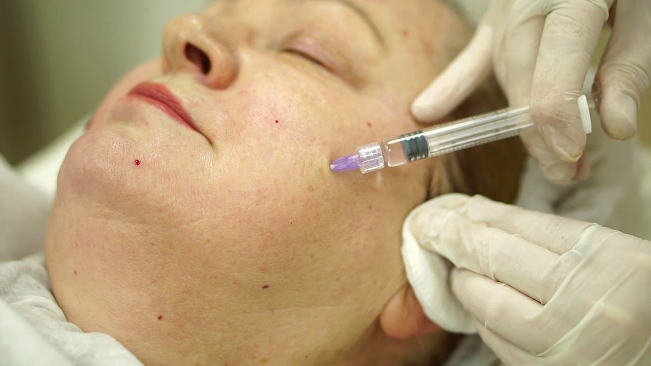 Meso Wharton (Мезовартон). смотреть онлайн