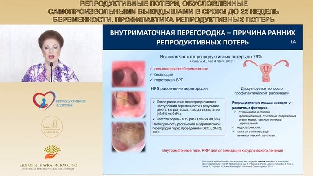 ONLINE - лекция: Репродуктивные потери, обусловленные самопроизвольными выкидышами. смотреть онлайн
