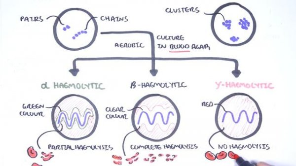 Microbiology - Streptococcus species