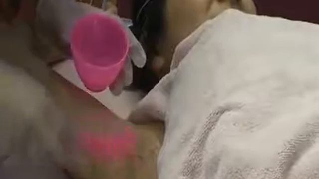 аппарата SHR эпиляции ADSS VE2020 Portable