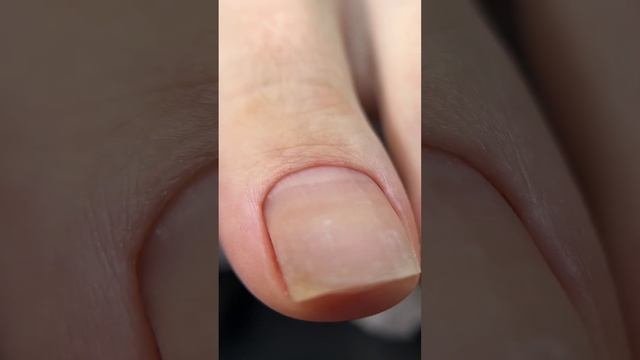 Почему нельзя перенашивать покрытие? #manicurepedicure #pedicure #gelnails смотреть онлайн