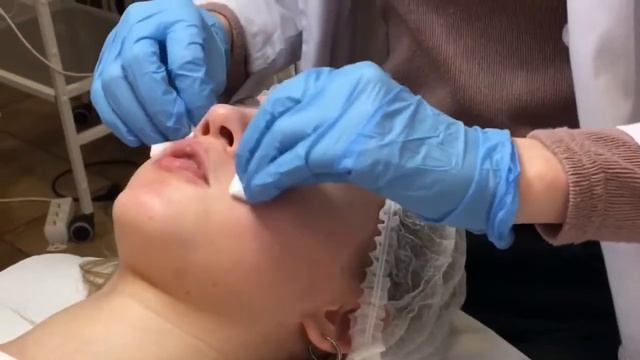 ПОПУЛЯРНЫЕ ДВЕ ПРОЦЕДУРЫ ??♀️ В КОСМЕТОЛОГИЧЕСКОМ САЛОНЕ