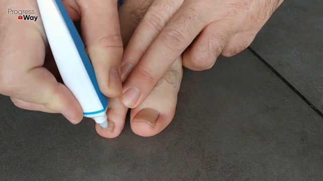 ГРИБОК НОГТЕЙ быстро исчезнет, если 3 минуты в день применять этот способ! смотреть онлайн