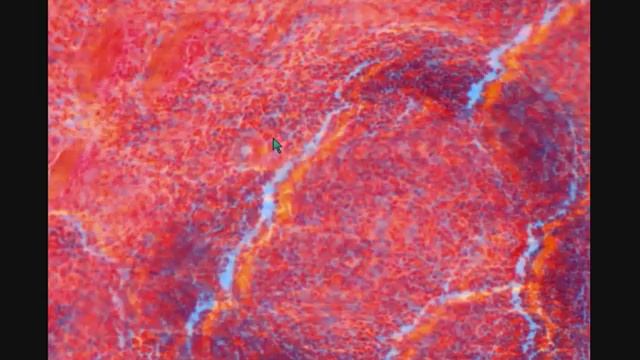 СЕЛЕЗЕНКА. SPLEEN. Срез в световой микроскоп. смотреть онлайн