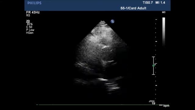 ДАК ПМК смотреть онлайн