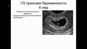 Ультразвуковая диагностика беременности. I триместр