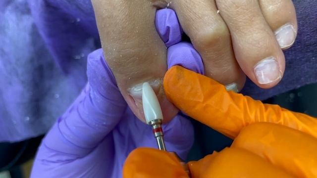 Лишилась НОГТЯ На Ноге ?