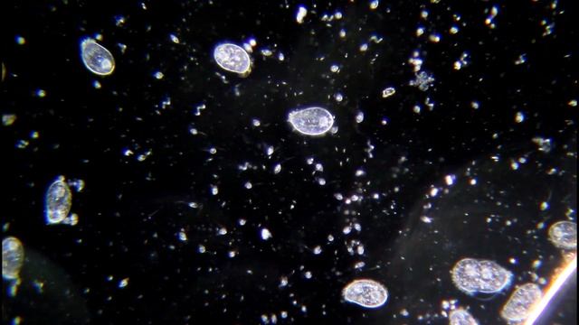 Вода из под цветов под микроскопом смотреть онлайн