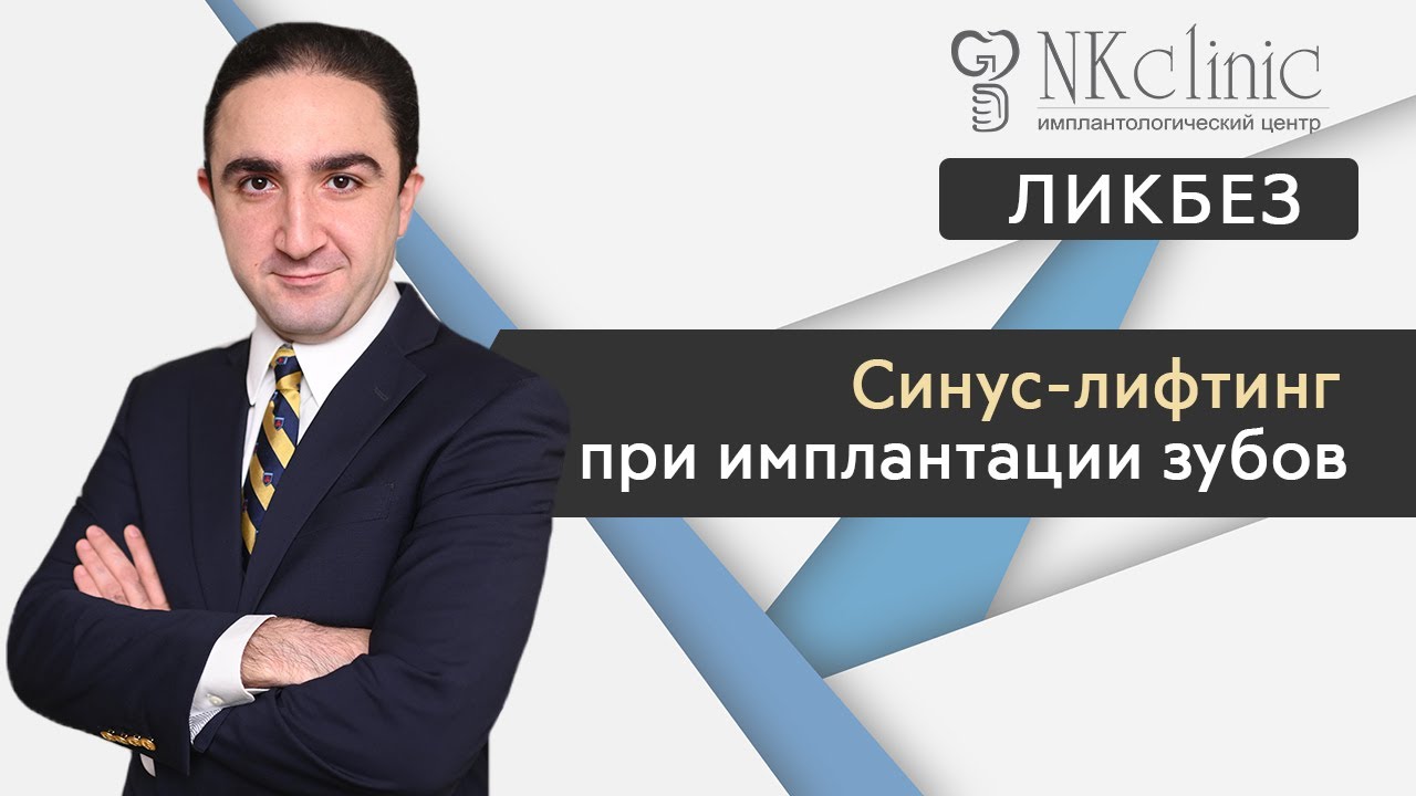 Синус-лифтинг при имплантации зубов  | Блог #9 | NKClinic
