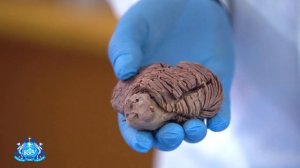 Внешнее строение мозжечка головного мозга | Лекция