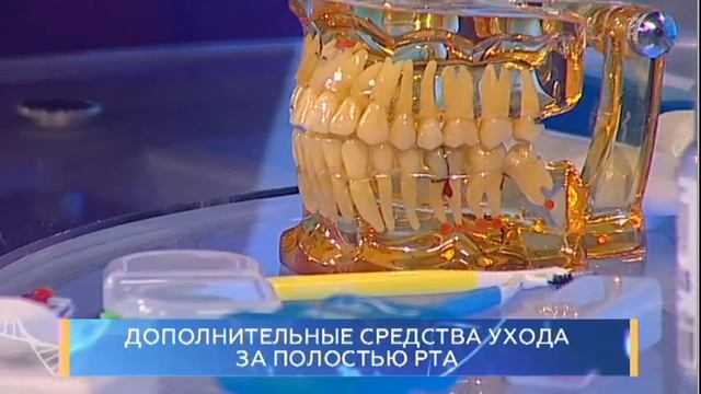 Дополнительные средства ухода за полостью рта. Школа здоровья. GuberniaTV смотреть онлайн