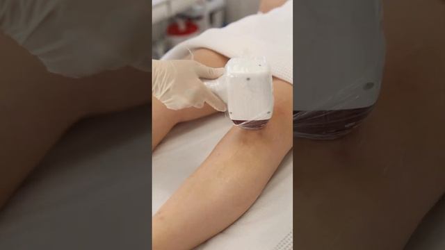 Hair Removel смотреть онлайн