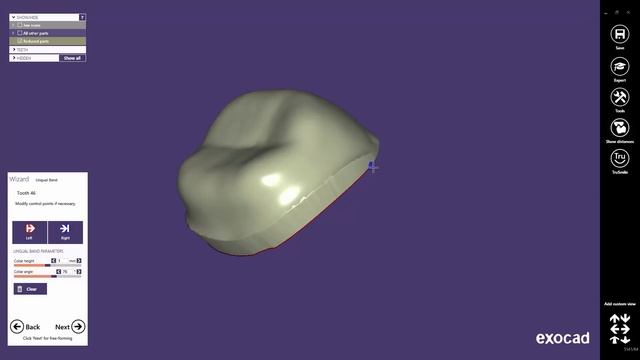 exocad Video Tutorial: Introduction to Basic Features / Offset Coping Design смотреть онлайн