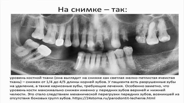 Повод для огромной благодарности за СуперПродукты NSP часть 2 Ольга Шершун, врач-нутрициолог смотреть онлайн