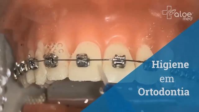Vídeo Demonstrativo DentVap | Aloemed смотреть онлайн