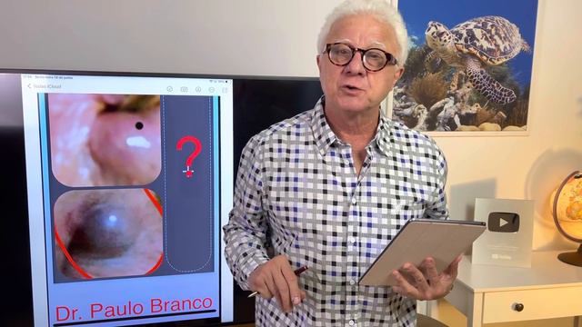 Bolinha dura no ânus , o que fazer? смотреть онлайн