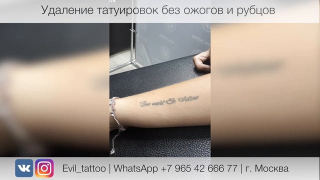 Лазерное удаление татуировки в студии Evil Tattoo. Без травм, ожогов и рубцов. смотреть онлайн