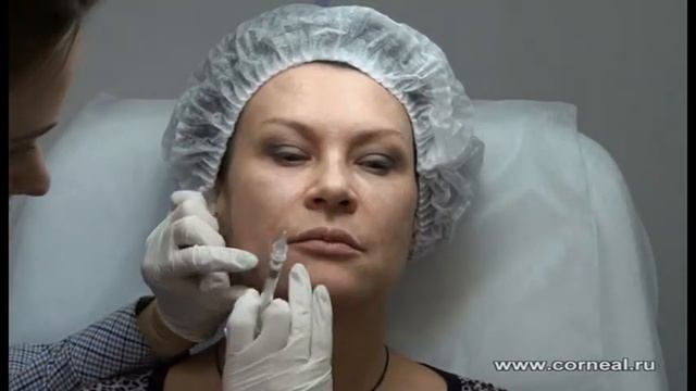 Канюля когда задача укрепить смотреть онлайн