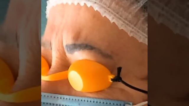 Удаление татуажа. смотреть онлайн