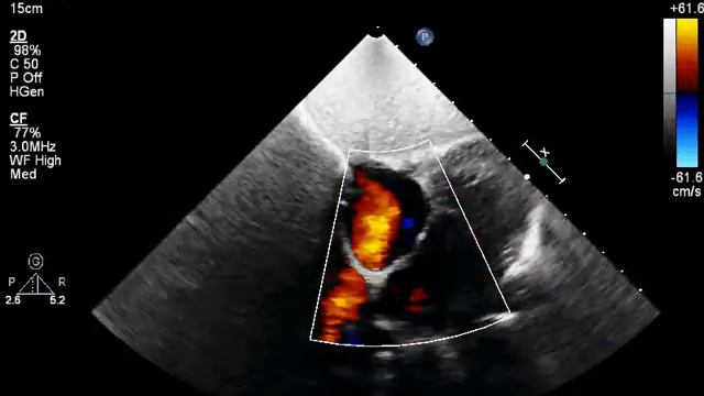 FATTAHOVA20130314150007739 смотреть онлайн