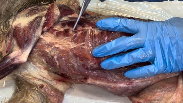 Мышцы грудной стенки смотреть онлайн