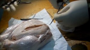 ПХО - первичная хирургическая обработка раны