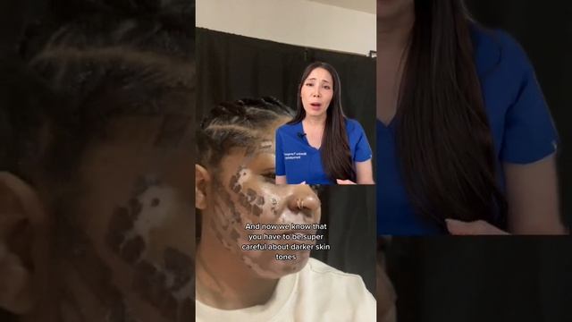 BBL laser facial смотреть онлайн