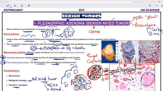 GIT 5 (DISEASES OF SALIVARY GLANDS) смотреть онлайн