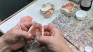 Починка пластиночного протеза (отлом, перелом, трещина, «доварка» зубов, отлом кламмера)