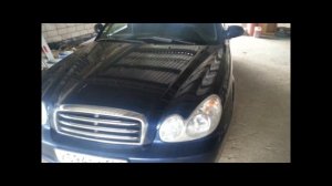 Перегрев двигателя Hyundai Sonata, решение проблемы. Совет/Лайфхак/