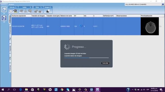Instalación Software Planmeca Romexis desde Dicom смотреть онлайн