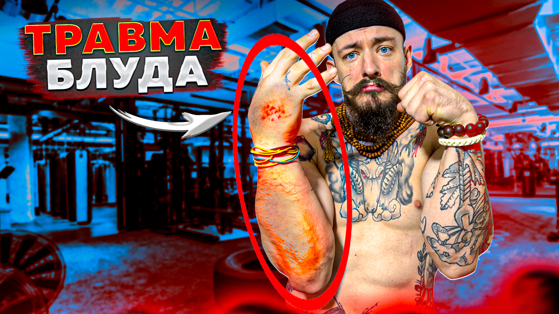 ТРАВМА ВИКТОРА БЛУДА смотреть онлайн