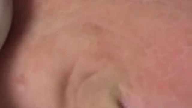 DermaSweep Microdermabrasion Techniques. www.drzachary.net смотреть онлайн