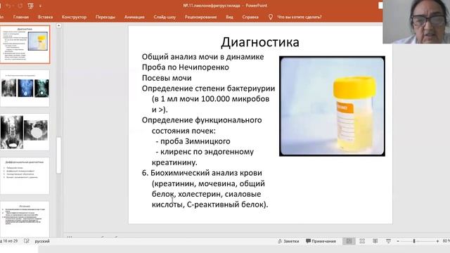 Пиелонефрит у детей