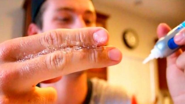 Как избавится от супер клея застывшего на пальцах смотреть онлайн