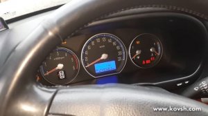 Причина затруднённого холодного запуска Hyundai Santa Fe — неисправные форсунки