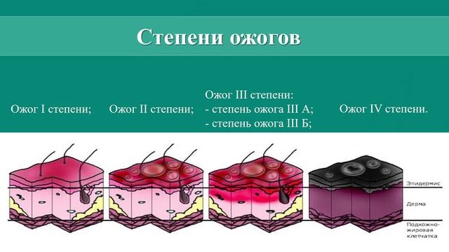 Серия 17. Правила оказания первой помощи при ожогах. смотреть онлайн