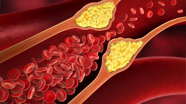 The HIDDEN cause of heart disease that EVERYONE MUST KNOW! смотреть онлайн
