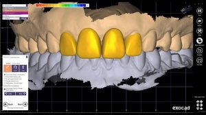 How To Design Mockup in exocad and make a 3D Printer Model