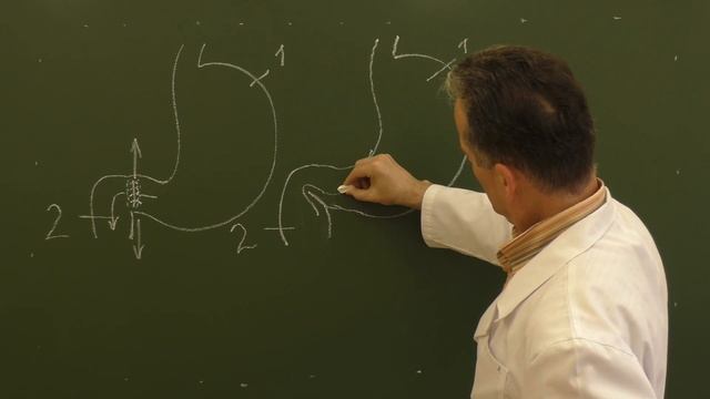 Пилоропластика смотреть онлайн