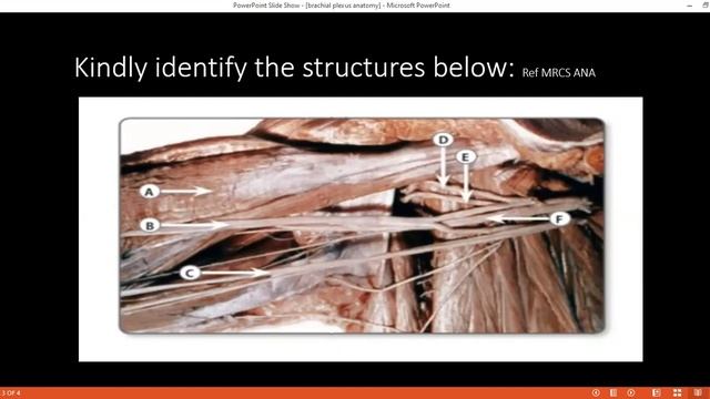SURGICAL ANATOMY STATION OF BRACHIAL PLEXUS смотреть онлайн