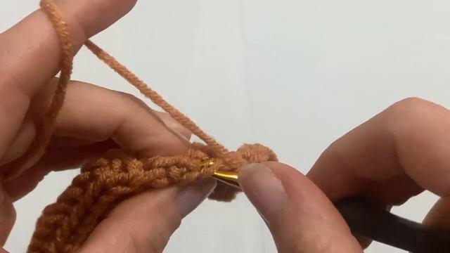 YURT DIŞINDA 175€ BİZ 60₺ YAPTIK