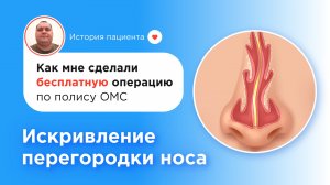 Как я сделал операцию бесплатно по ОМС — септопластика при искривлении перегородки носа