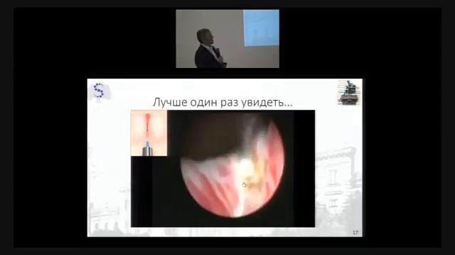 Конгресс урологов ч.3 смотреть онлайн