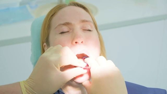 Оттискная ложка с удаляемыми сегментами смотреть онлайн