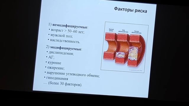 Аортальные пороки. Пропедевтика. Глазунов. Часть 2 смотреть онлайн